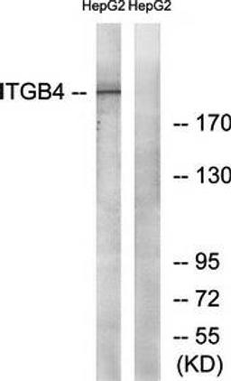 Western blot analysis of extracts from HepG2 cells using Integrin beta4 antibody