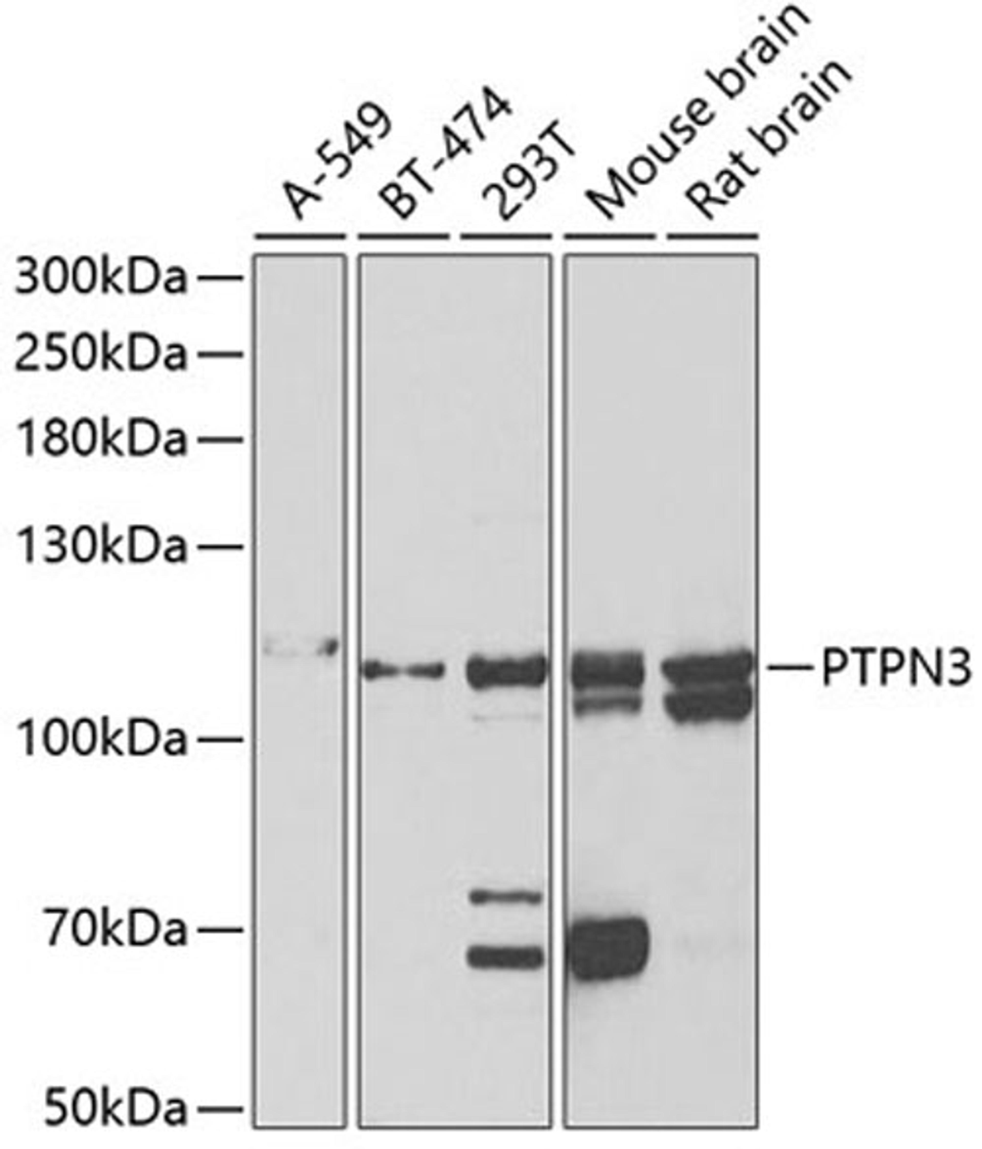 Western blot - PTPN3 antibody (A6400)