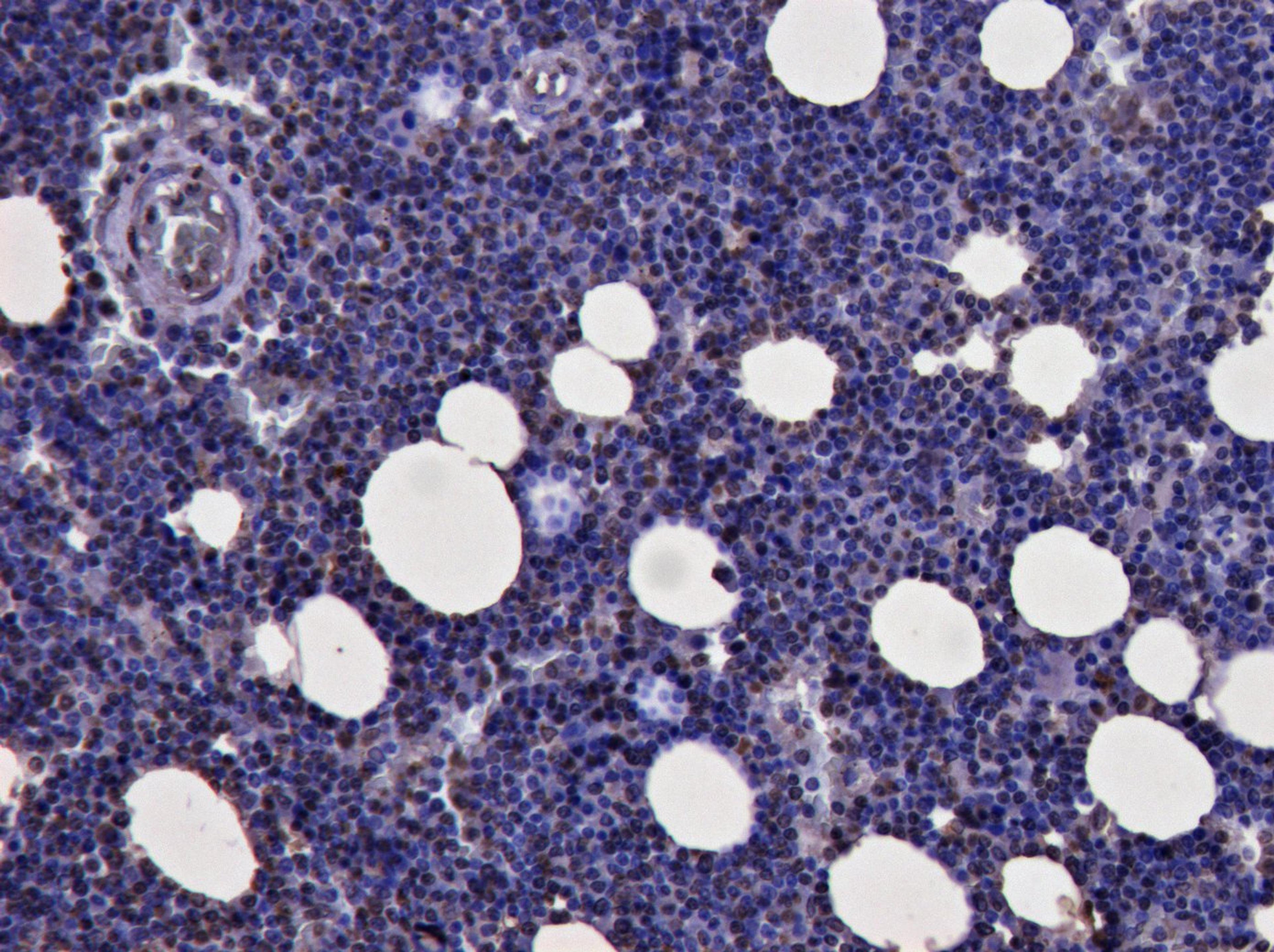 45-801 (3ug/ml) staining of paraffin embedded Human Bone Marrow. Heat induced antigen retrieval with citrate buffer pH 6, HRP-staining.