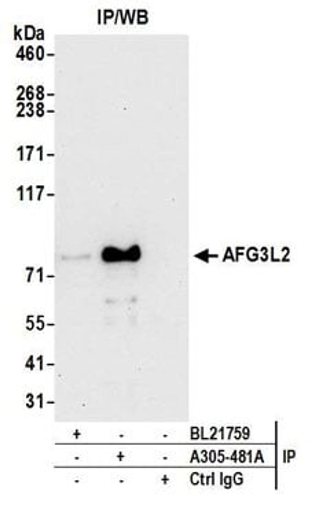 Detection of human AFG3L2 by western blot of immunoprecipitates.