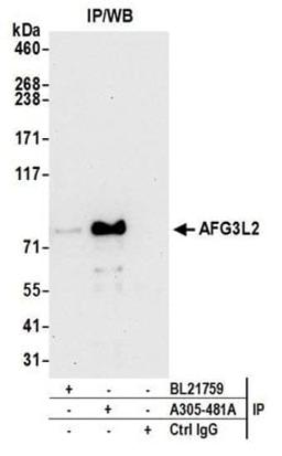 Detection of human AFG3L2 by western blot of immunoprecipitates.