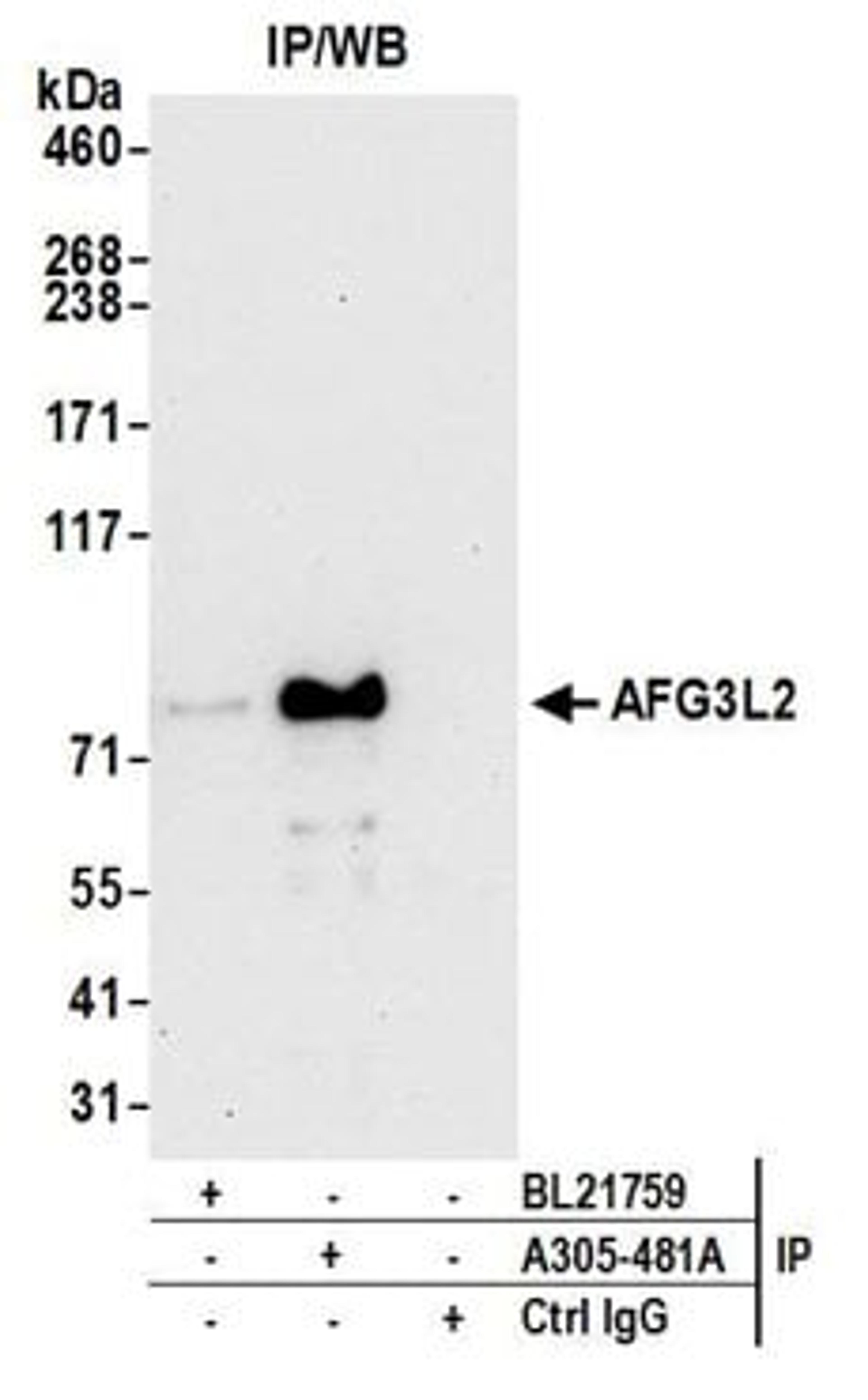 Detection of human AFG3L2 by western blot of immunoprecipitates.