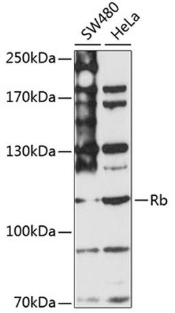 Western blot - Rb antibody (A16966)