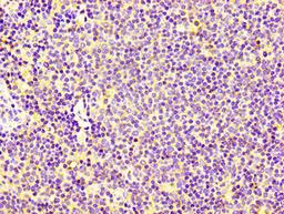 IHC image of CSB-PA005666LA01HU diluted at 1:100 and staining in paraffin-embedded human lymph node tissue performed on a Leica BondTM system. After dewaxing and hydration, antigen retrieval was mediated by high pressure in a citrate buffer (pH 6.0). Section was blocked with 10% normal goat serum 30min at RT. Then primary antibody (1% BSA) was incubated at 4°C overnight. The primary is detected by a biotinylated secondary antibody and visualized using an HRP conjugated SP system.