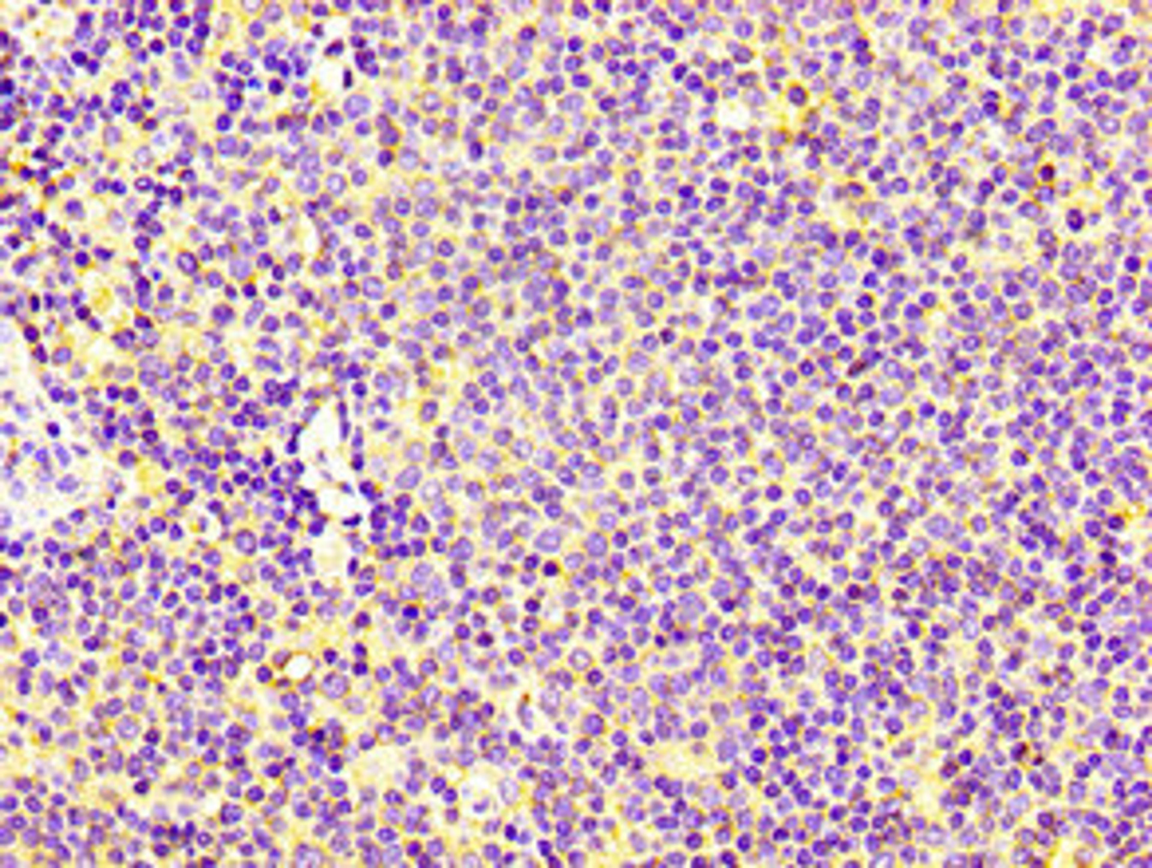 IHC image of CSB-PA005666LA01HU diluted at 1:100 and staining in paraffin-embedded human lymph node tissue performed on a Leica BondTM system. After dewaxing and hydration, antigen retrieval was mediated by high pressure in a citrate buffer (pH 6.0). Section was blocked with 10% normal goat serum 30min at RT. Then primary antibody (1% BSA) was incubated at 4°C overnight. The primary is detected by a biotinylated secondary antibody and visualized using an HRP conjugated SP system.
