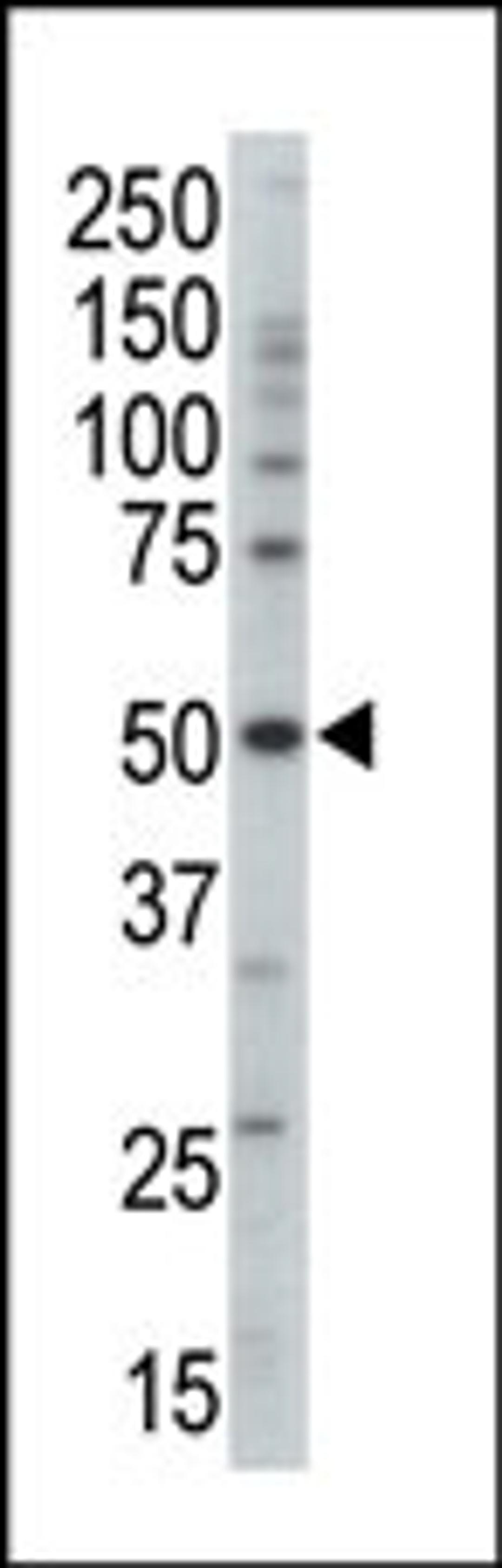 Western blot analysis of anti-PRKAG3 Pab in mouse brain tissue lysate