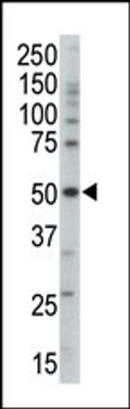 Western blot analysis of anti-PRKAG3 Pab in mouse brain tissue lysate