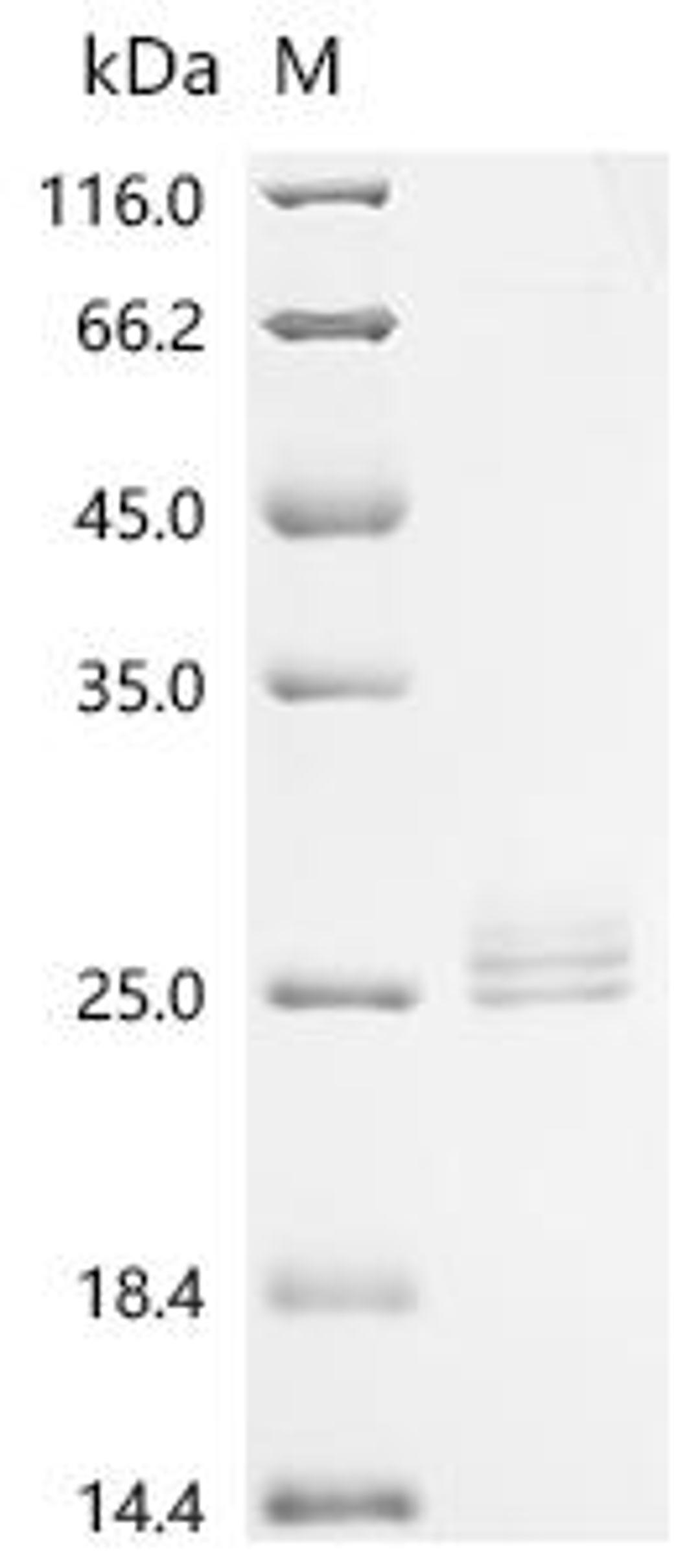 (Tris-Glycine gel) Discontinuous SDS-PAGE (reduced) with 5% enrichment gel and 15% separation gel.