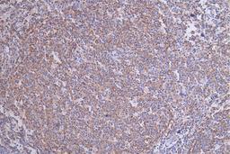 IHC image of CSB-RA783071A0HU diluted at 1:50 and staining in paraffin-embedded human tonsil tissue performed on a Leica BondTM system. After dewaxing and hydration, antigen retrieval was mediated by high pressure in a citrate buffer (pH 6.0). Section was blocked with 10% normal goat serum 30min at RT. Then primary antibody (1% BSA) was incubated at 4°C overnight. The primary is detected by a Goat anti-rabbit polymer IgG labeled by HRP and visualized using 0.17% DAB.