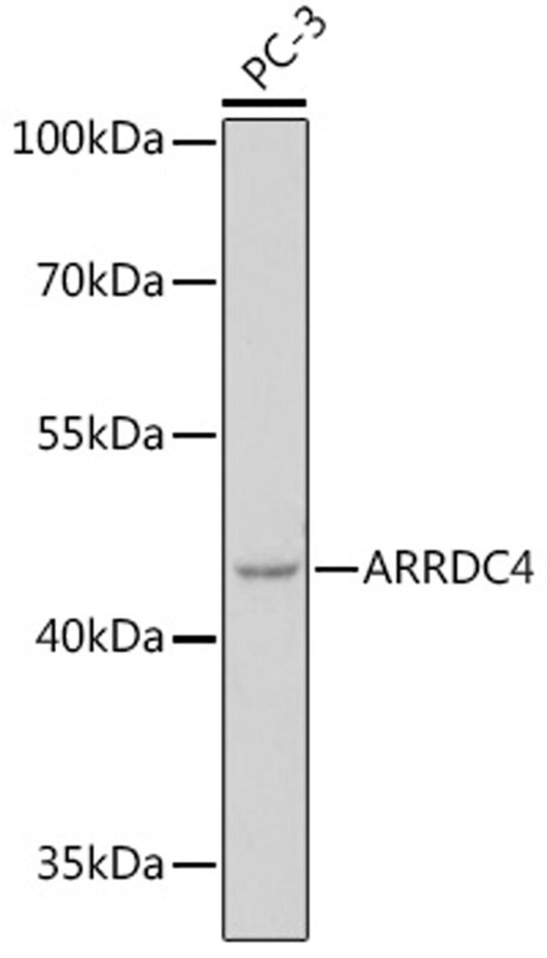 Western blot - ARRDC4 pAb (A18522)