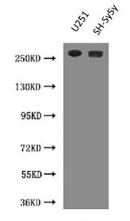 Western Blot. Positive WB detected in: U251 whole cell lysate, SH-SY5Y whole cell lysate. All lanes: NES antibody at 3µg/ml. Secondary. Goat polyclonal to Mouse IgG at 1/10000 dilution. Predicted band size: 178 kDa. Observed band size: 260 kDa. 