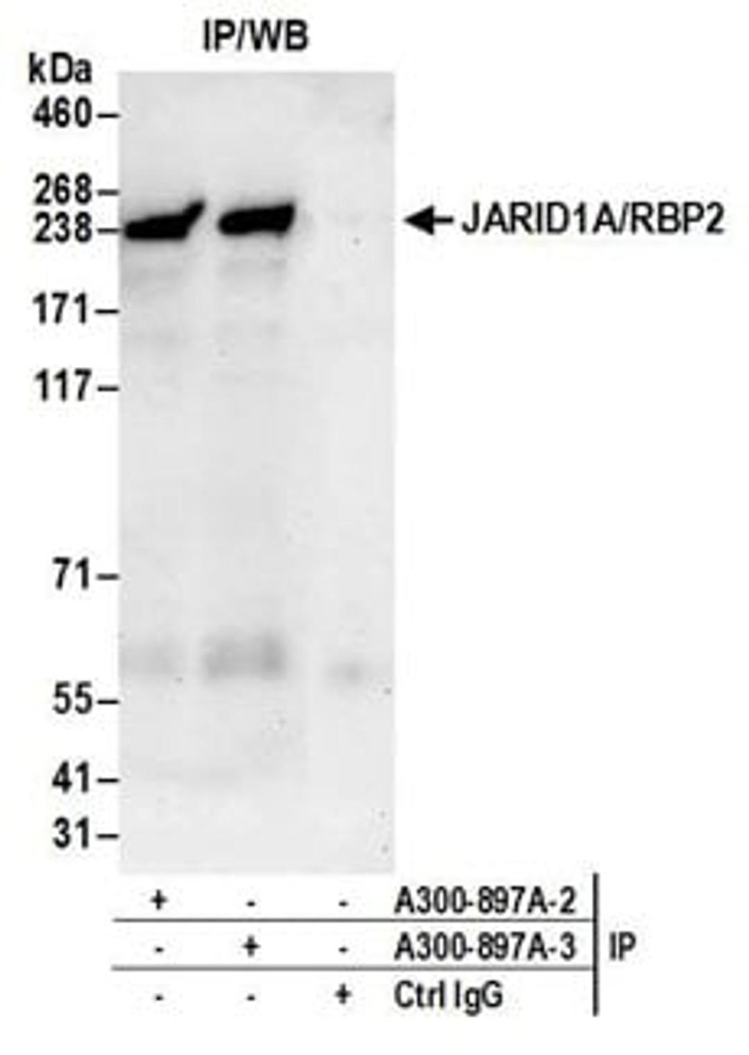 Detection of human JARID1A/RBP2 by western blot of immunoprecipitates.