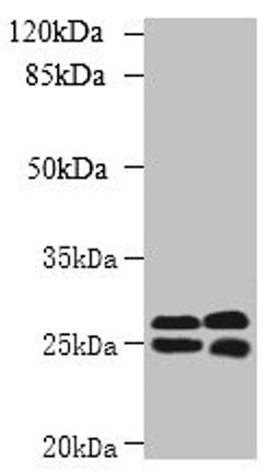 Western blot. All lanes: CMBL antibody at 1µg/ml. Lane 1: Mouse kidney tissue. Lane 2: Mouse liver tissue. Secondary. Goat polyclonal to rabbit IgG at 1/10000 dilution. Predicted band size: 29 kDa. Observed band size: 29, 25 kDa