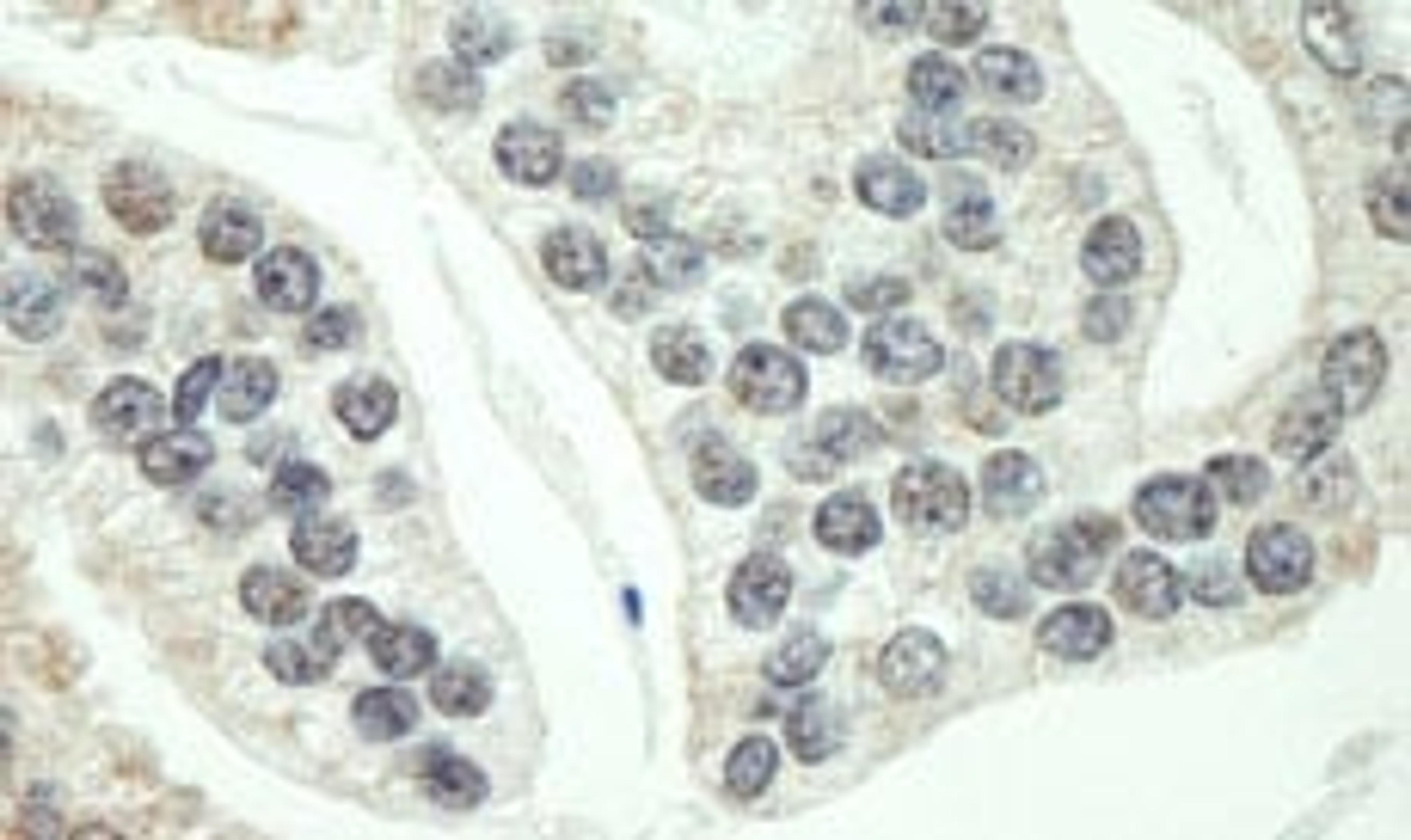 Detection of human RNF40 by immunohistochemistry.