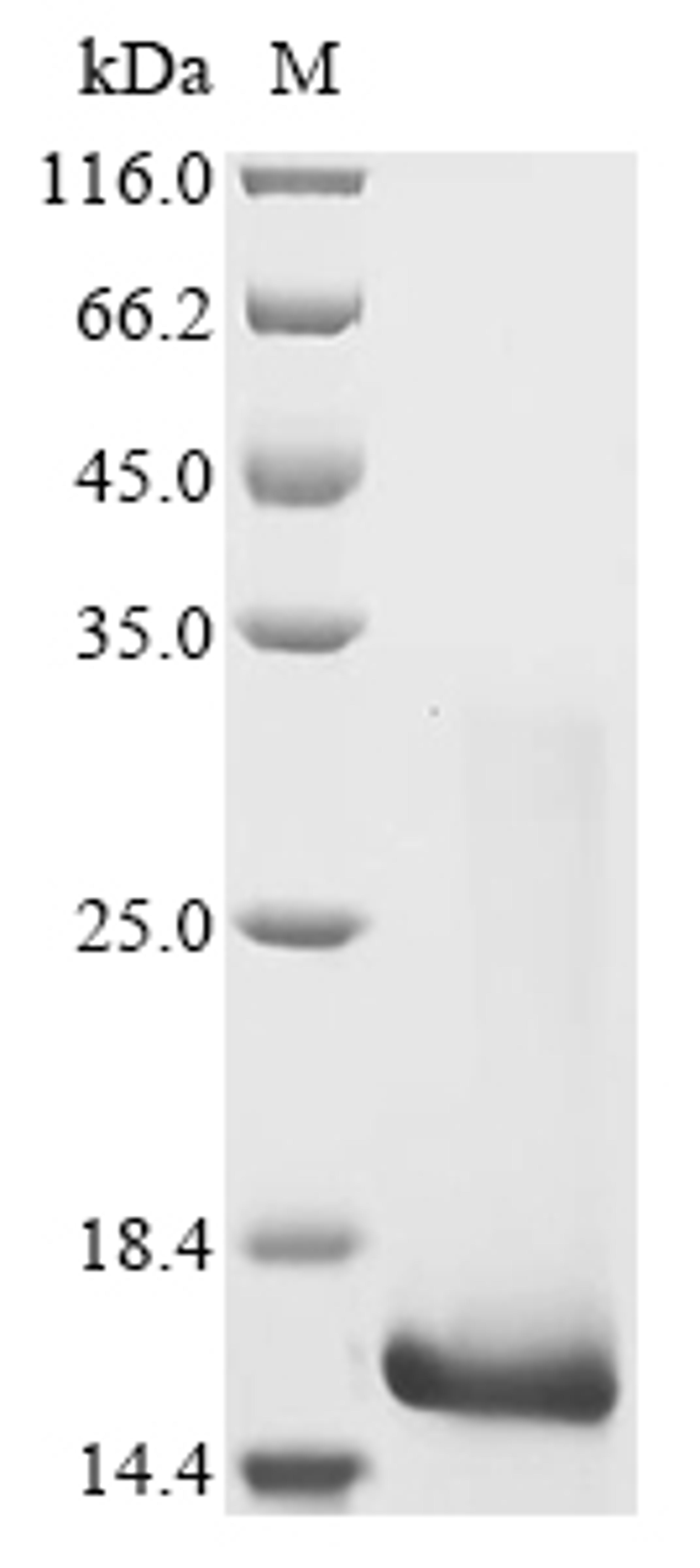(Tris-Glycine gel) Discontinuous SDS-PAGE (reduced) with 5% enrichment gel and 15% separation gel.