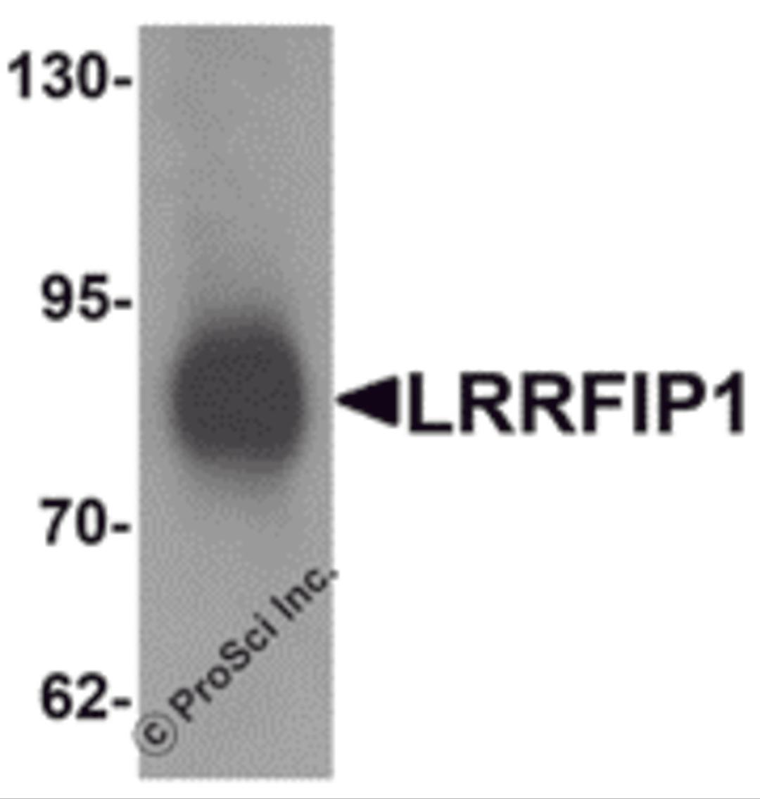 Western blot analysis of LRRFIP1 in human colon tissue lysate with LRRFIP1 antibody at 1 μg/mL.
