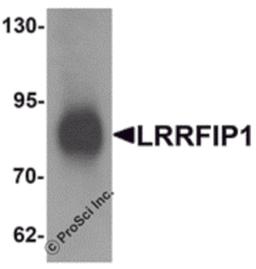 Western blot analysis of LRRFIP1 in human colon tissue lysate with LRRFIP1 antibody at 1 μg/mL.