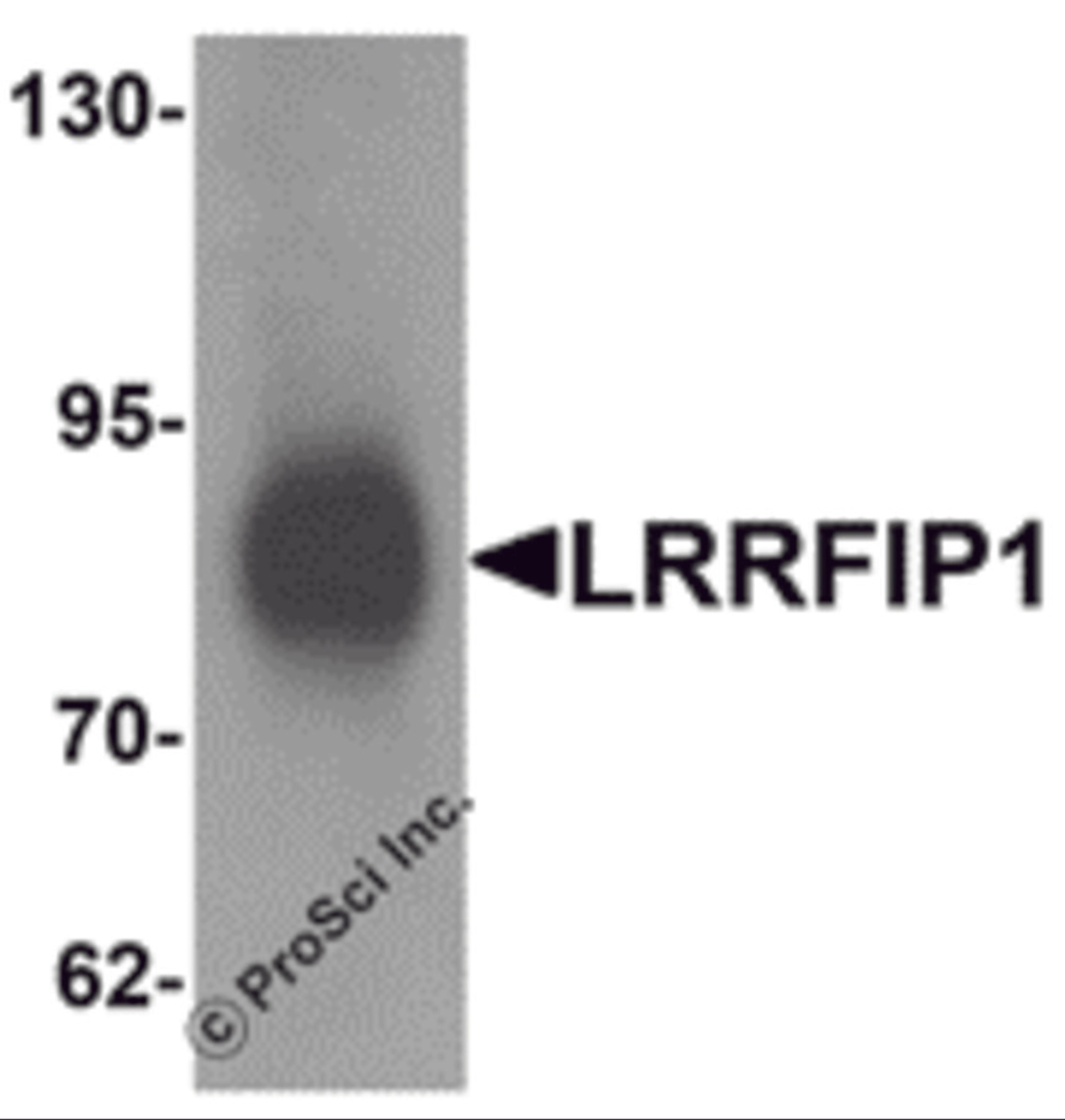 Western blot analysis of LRRFIP1 in human colon tissue lysate with LRRFIP1 antibody at 1 μg/mL.