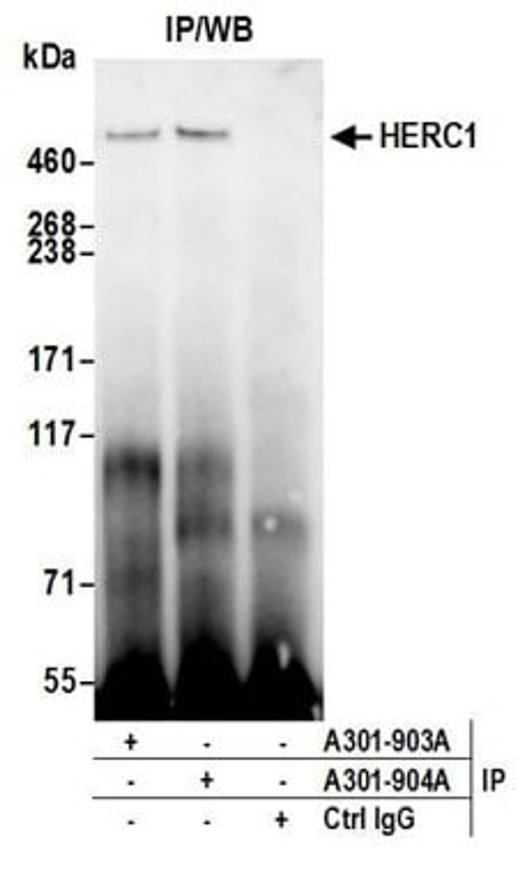 Detection of human HERC1 by western blot of immunoprecipitates.