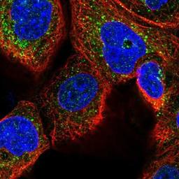 Immunocytochemistry/Immunofluorescence: WDTC1 Antibody [NBP1-89233] - Staining of human cell line A-431 shows positivity in vesicles.