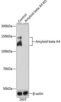 Western blot - Amyloid beta A4 antibody (A17911)