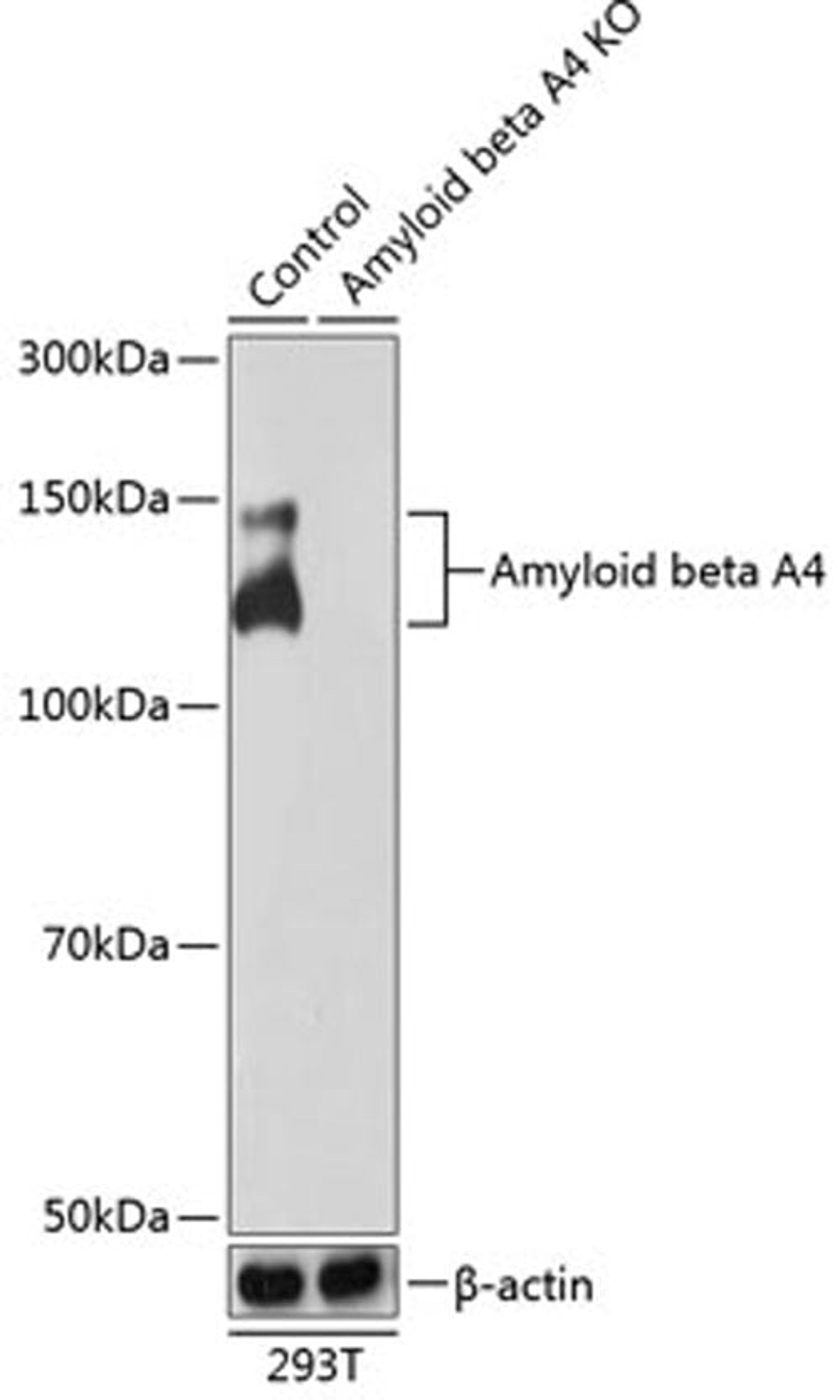 Western blot - Amyloid beta A4 antibody (A17911)