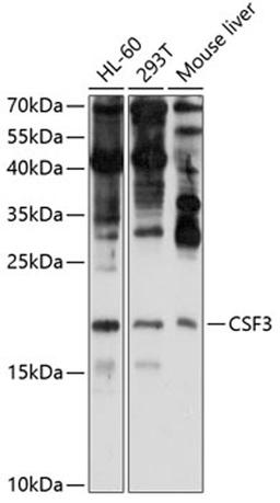 Western blot - CSF3 antibody (A6178)