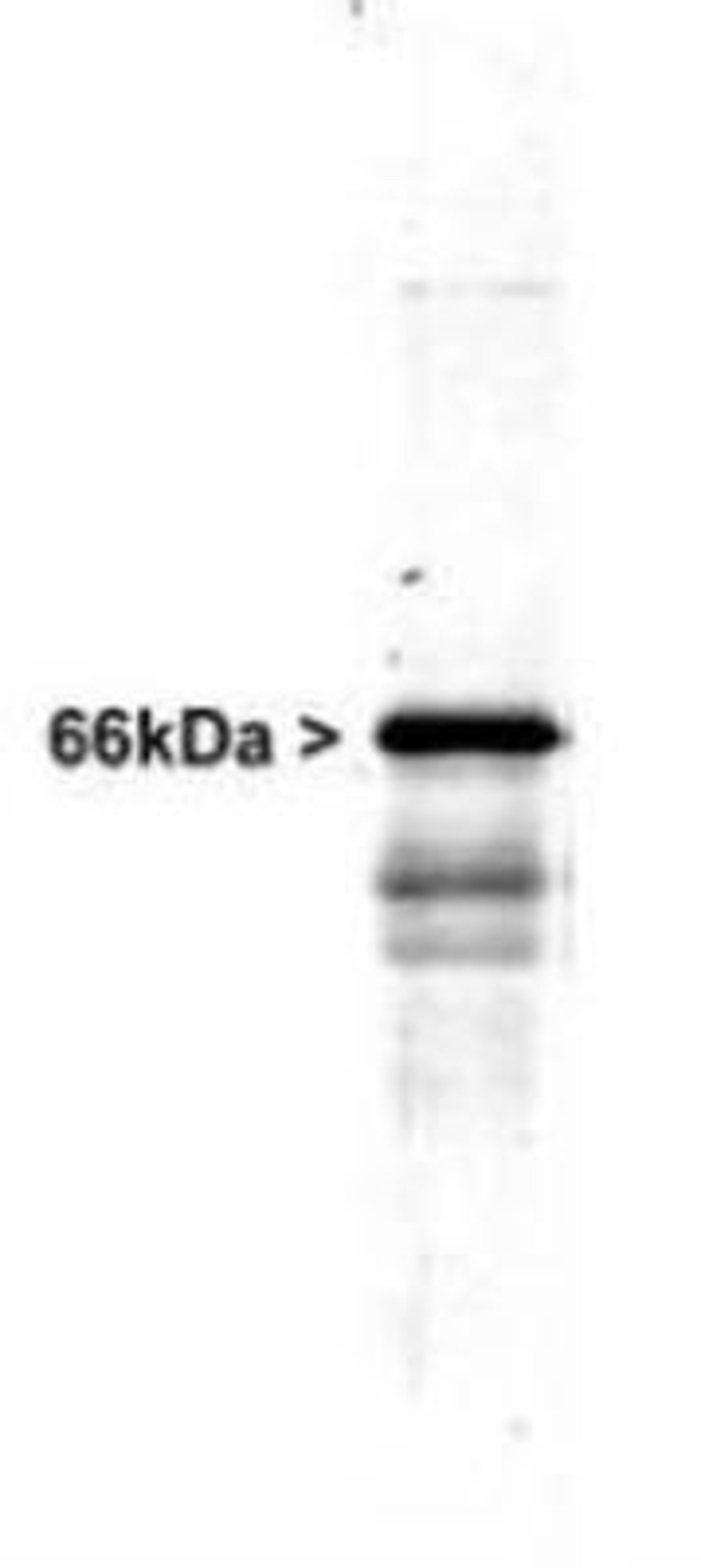 Western Blot: alpha Internexin Antibody [NB300-139] - Western blot of whole rat spinal cord homogenate stained with RPCA-a-Int, at dilution of 1:20,000. A prominent band running at ~66kDa is apparent, as well as smaller lower bands which are apparently degradation products. A minor band at ~150kDa is also seen, apparently resulting from dimerization of alpha-internexin.