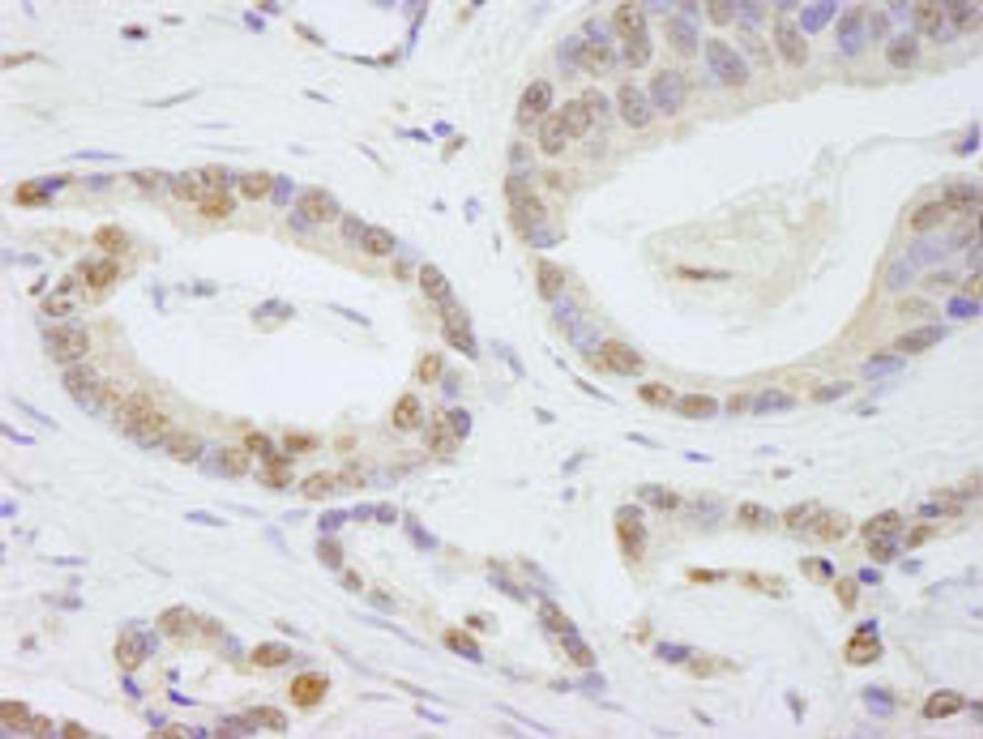 Detection of human TAF6 by immunohistochemistry.