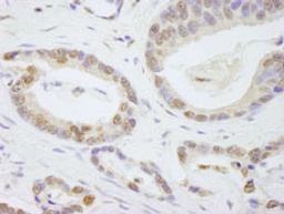 Detection of human TAF6 by immunohistochemistry.