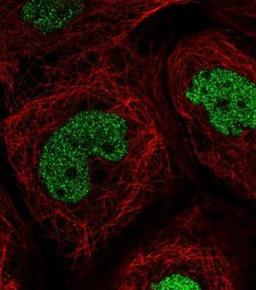 Immunocytochemistry/Immunofluorescence: TEAD4 Antibody [NBP2-33803] - Staining of human cell line A-431 shows positivity in nucleus but excluded from the nucleoli.