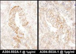 Detection of human AE2 by immunohistochemistry.