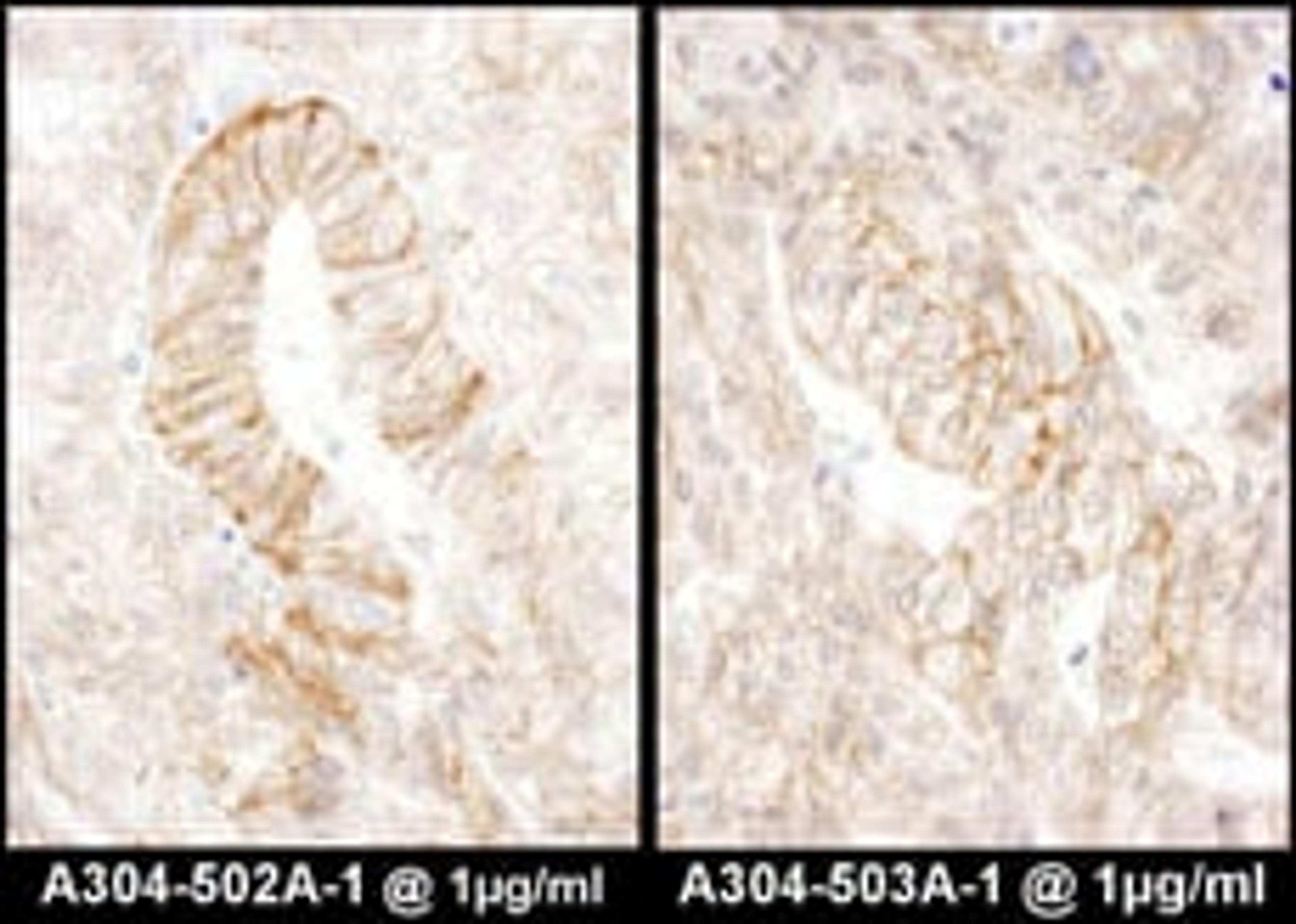 Detection of human AE2 by immunohistochemistry.