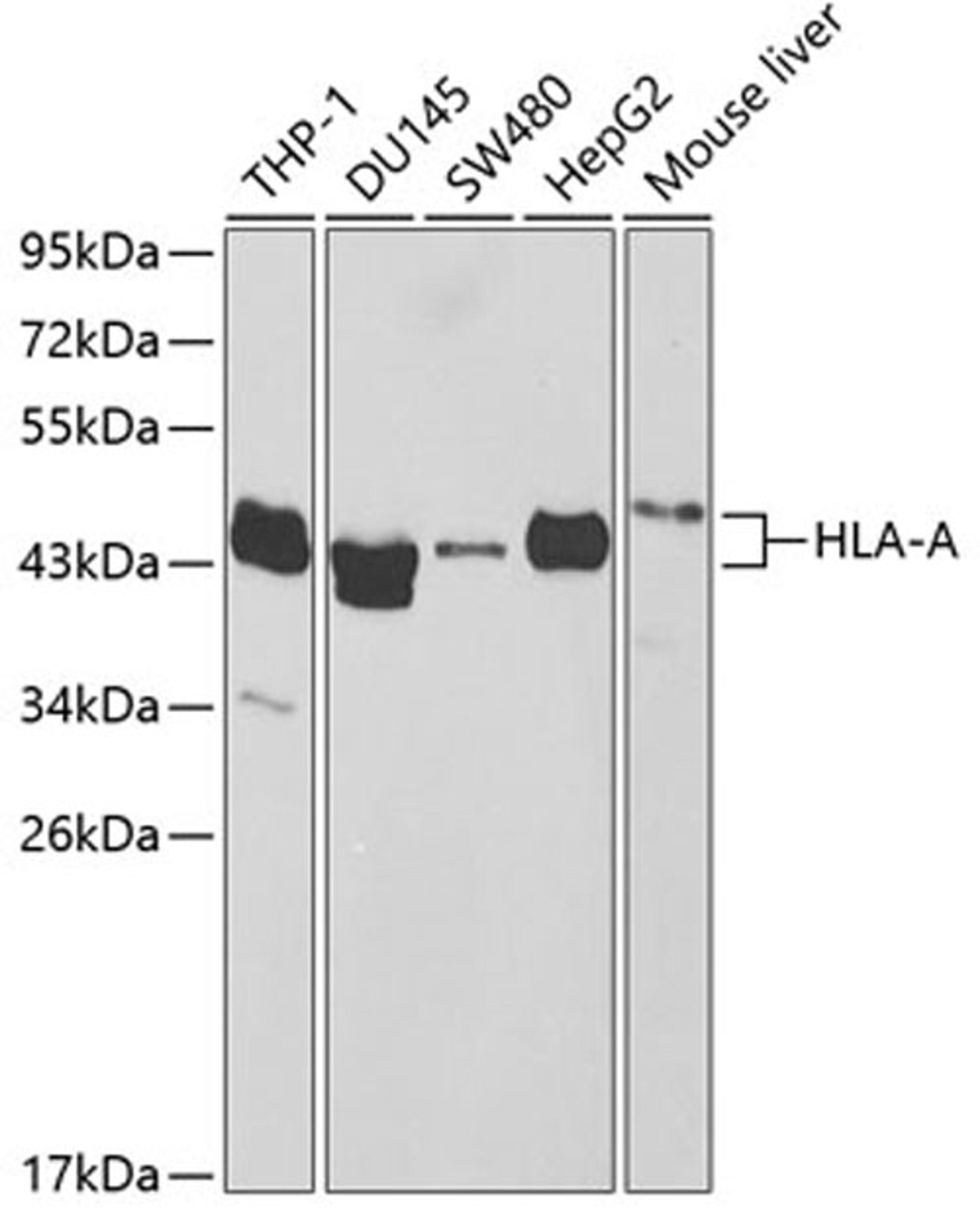 Western blot - HLA-A antibody (A2167)