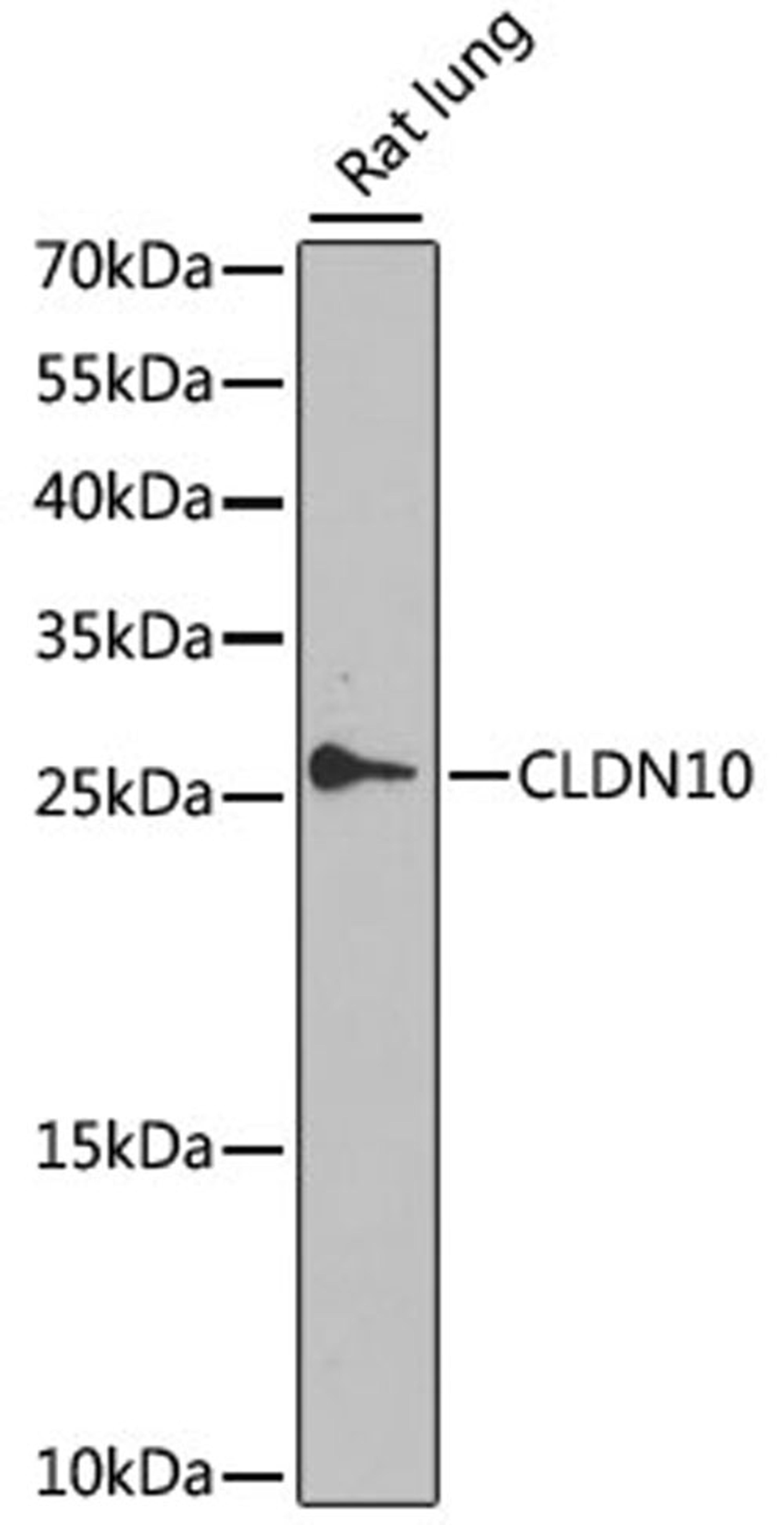 Western blot - CLDN10 antibody (A9853)