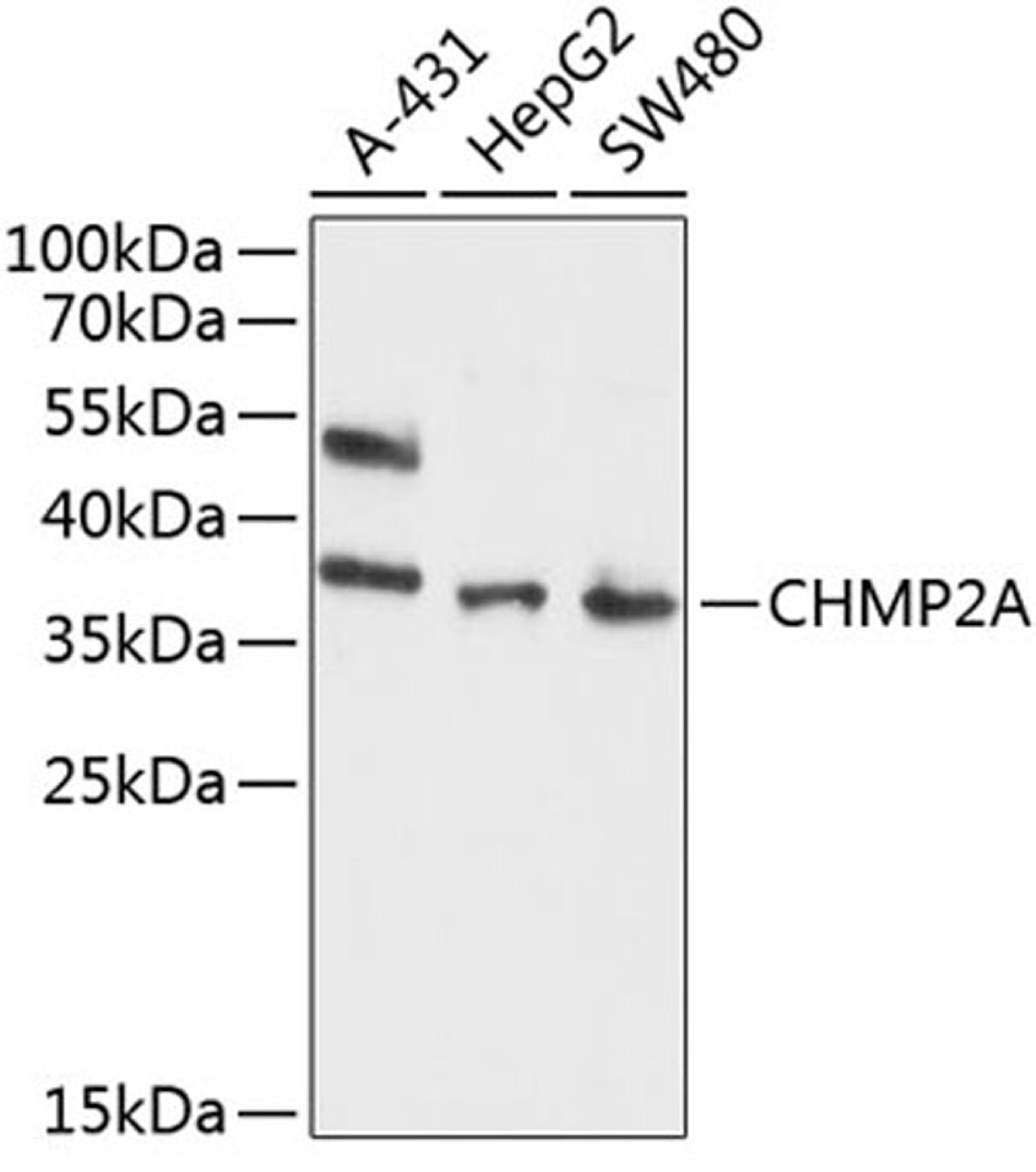 Western blot - CHMP2A antibody (A10380)