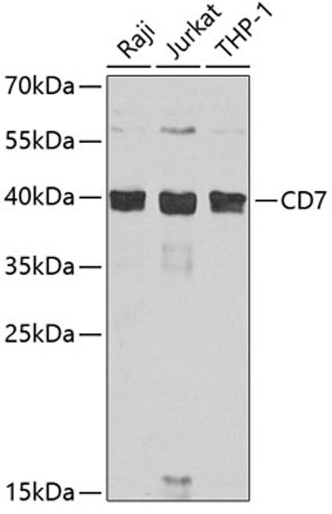 Western blot - CD7 antibody (A7650)