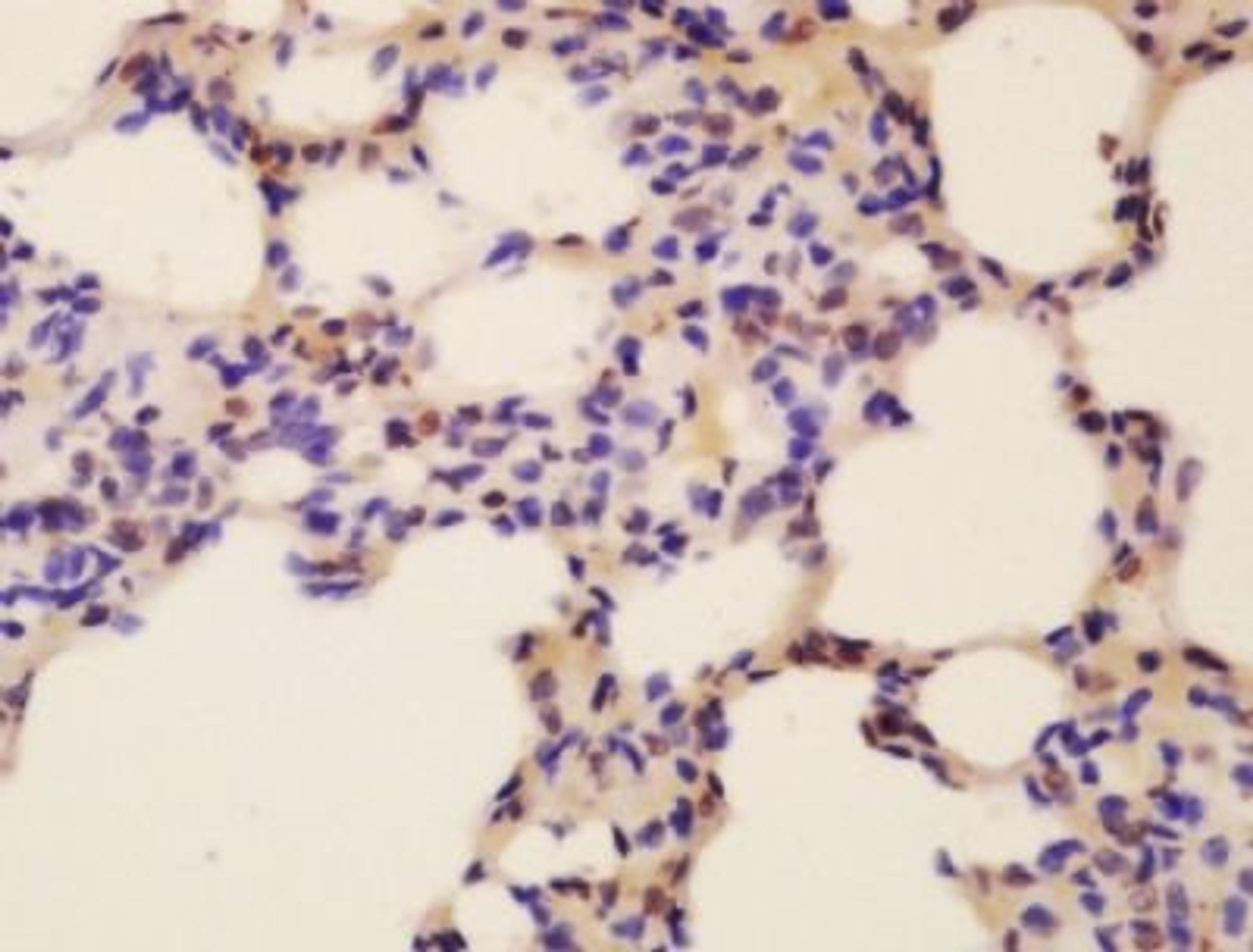 Immunohistochemical analysis of formalin-fixed paraffin embedded mouse lung tissue using Fox2 antibody (dilution at 1:200)