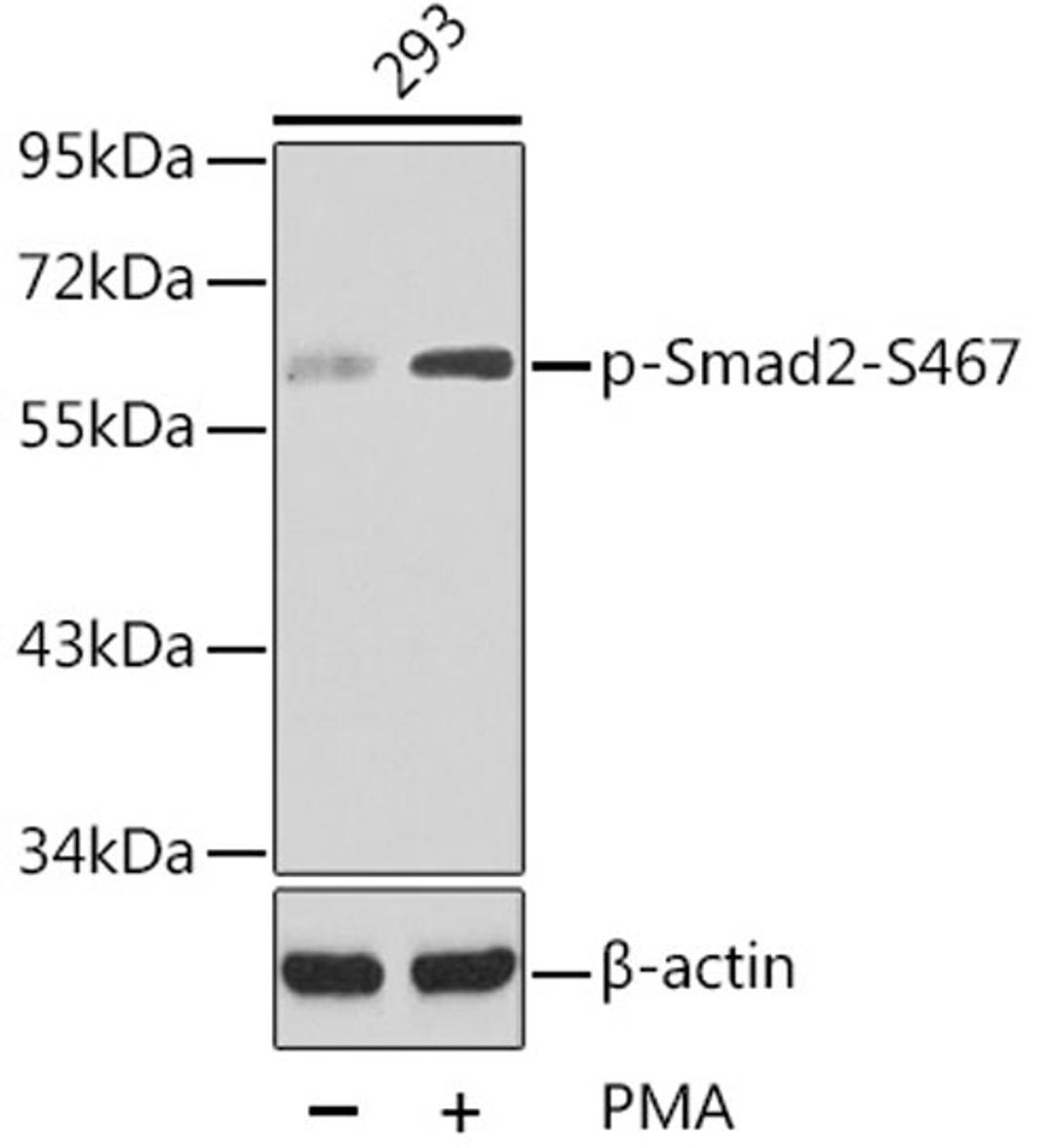 Western blot - Phospho-Smad2-S467 antibody (AP0269)