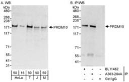 Detection of human and mouse PRDM10 by western blot (h and m) and immunoprecipitation (h).