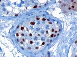 45-814 (3ug/ml) staining of paraffin embedded Human Testis. Microwaved antigen retrieval with citrate buffer pH 6, HRP-staining.