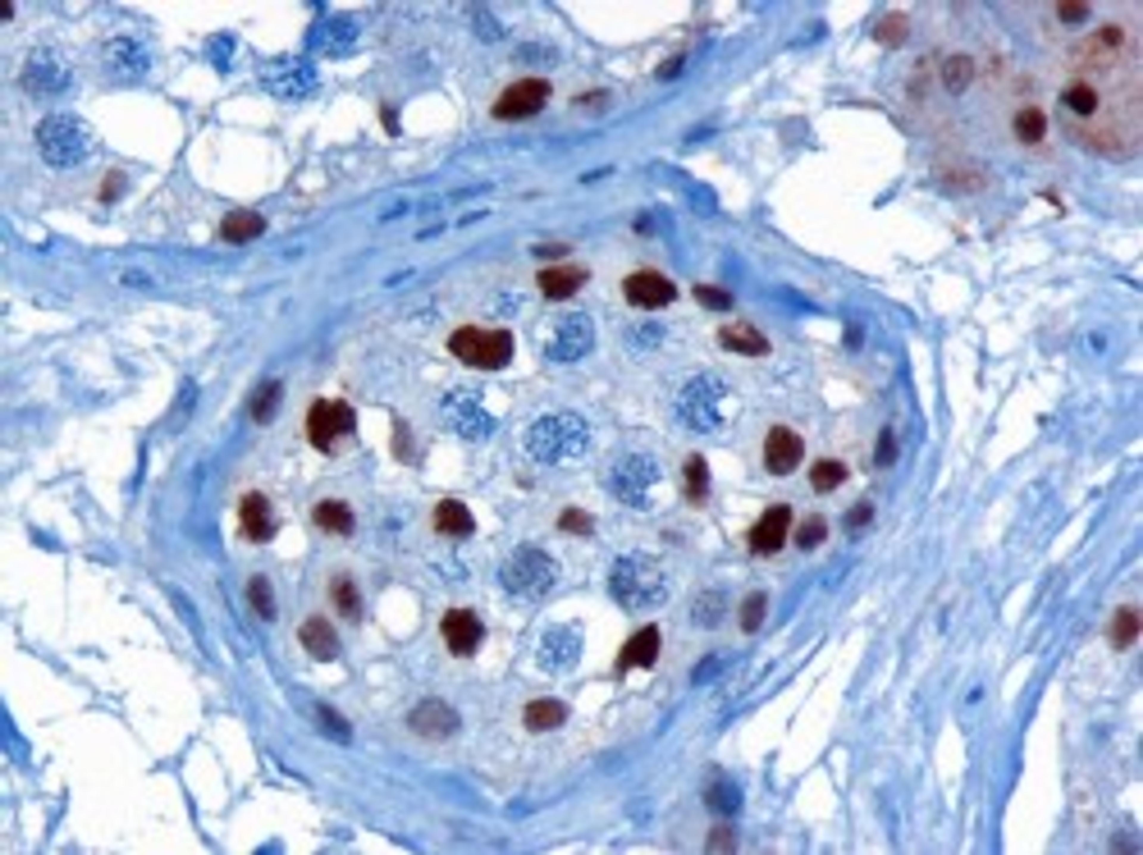 45-814 (3ug/ml) staining of paraffin embedded Human Testis. Microwaved antigen retrieval with citrate buffer pH 6, HRP-staining.