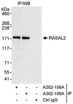 Detection of human RASAL2 by western blot of immunoprecipitates.