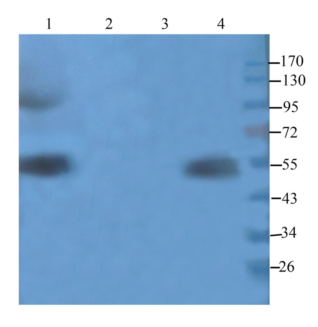 Western blot analysis of human breast tumour (lane 1), hela cells (lane 2),rat pancreas (lane 3),rat colon (lane 4) using Cathepsin G antibody (1 ug/ml)