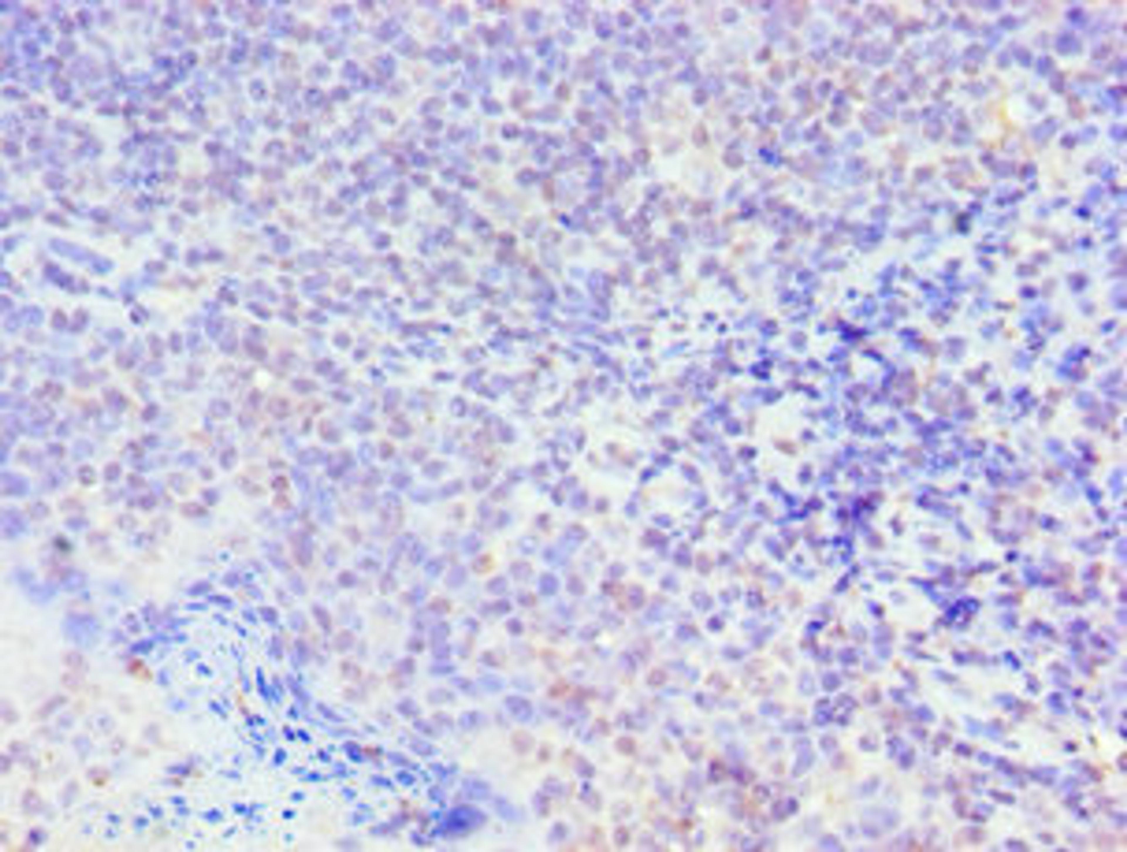 Immunohistochemistry of paraffin-embedded human tonsil tissue using CSB-PA021794ESR1HU at dilution of 1:100
