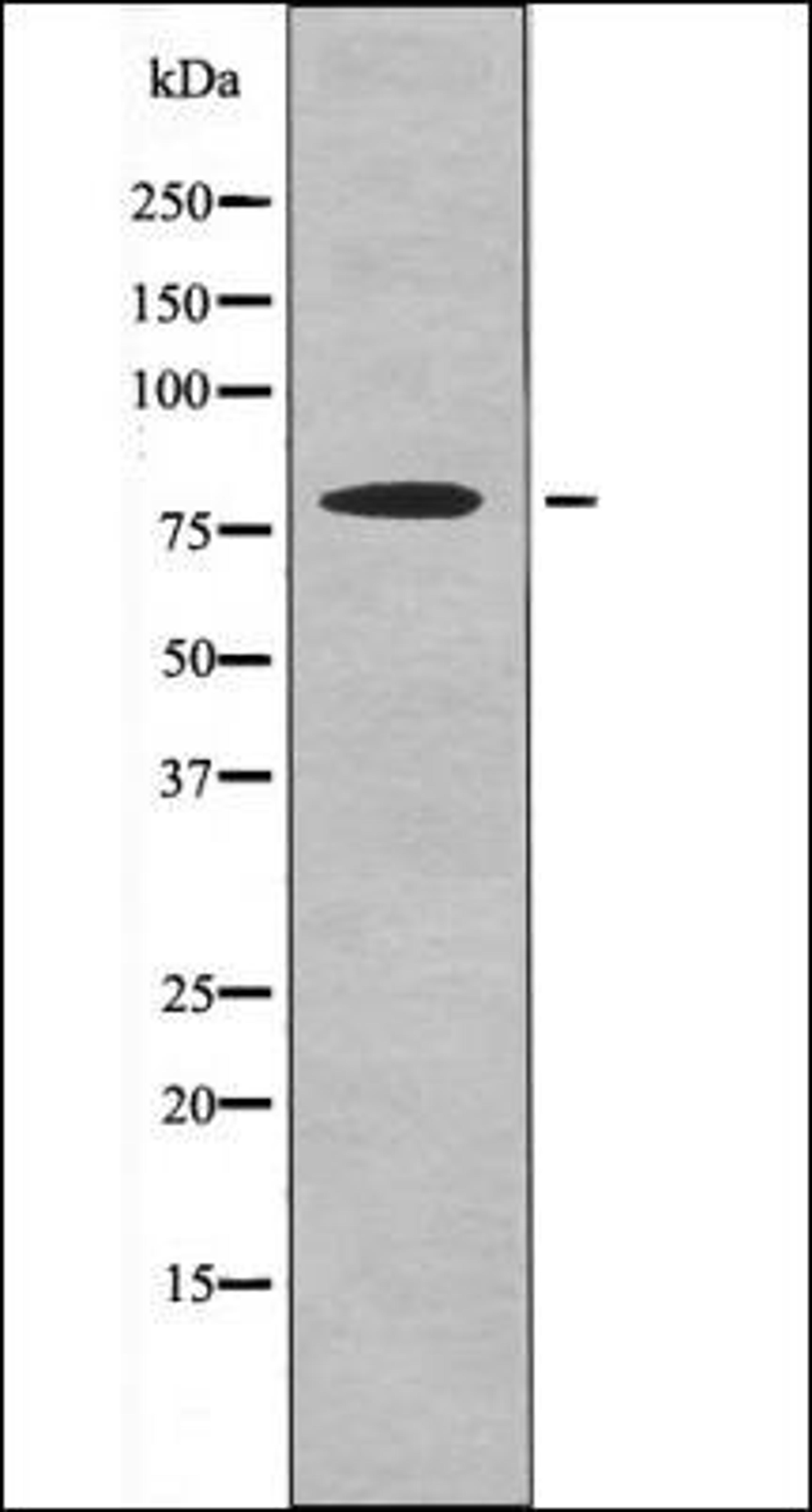 Western blot analysis of EGF treated Jurkat whole cell lysates using RSK3 -Phospho-Ser360- antibody