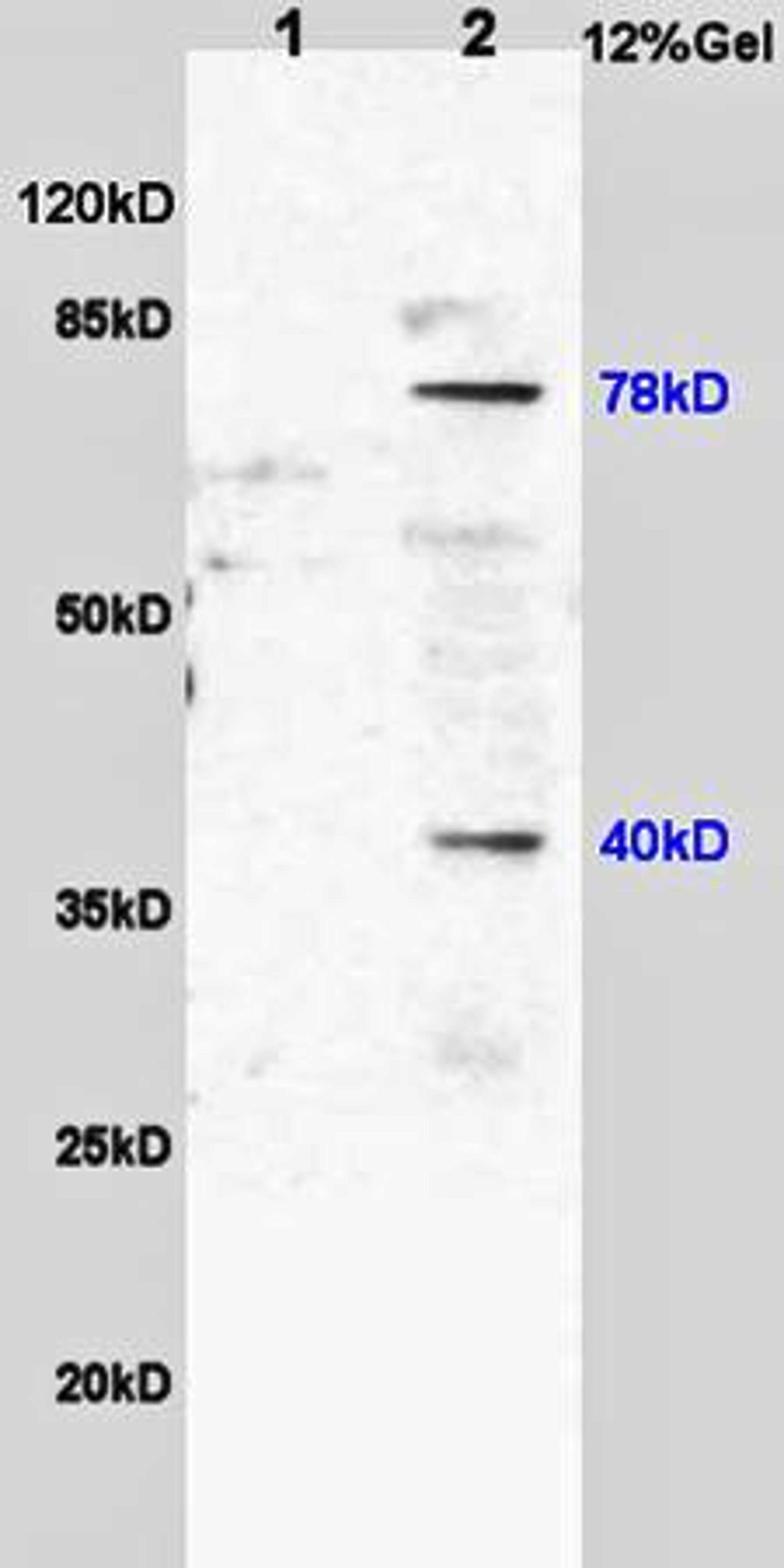 Western blot analysis of rat brain lysates(Lane1),mouse intestine lysates(Lane2) using 5-Lipoxygenase antibody