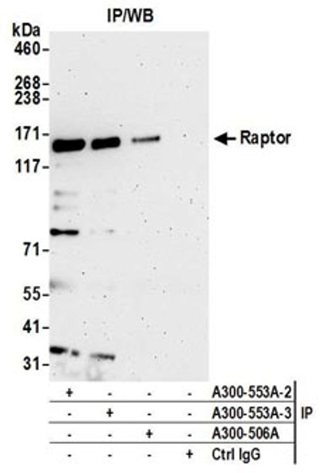 Detection of human Raptor by western blot of immunoprecipitates.