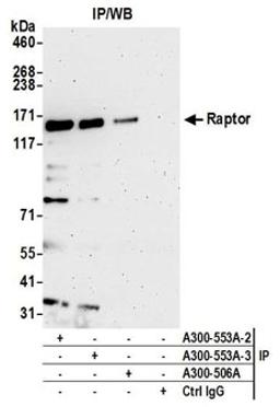 Detection of human Raptor by western blot of immunoprecipitates.