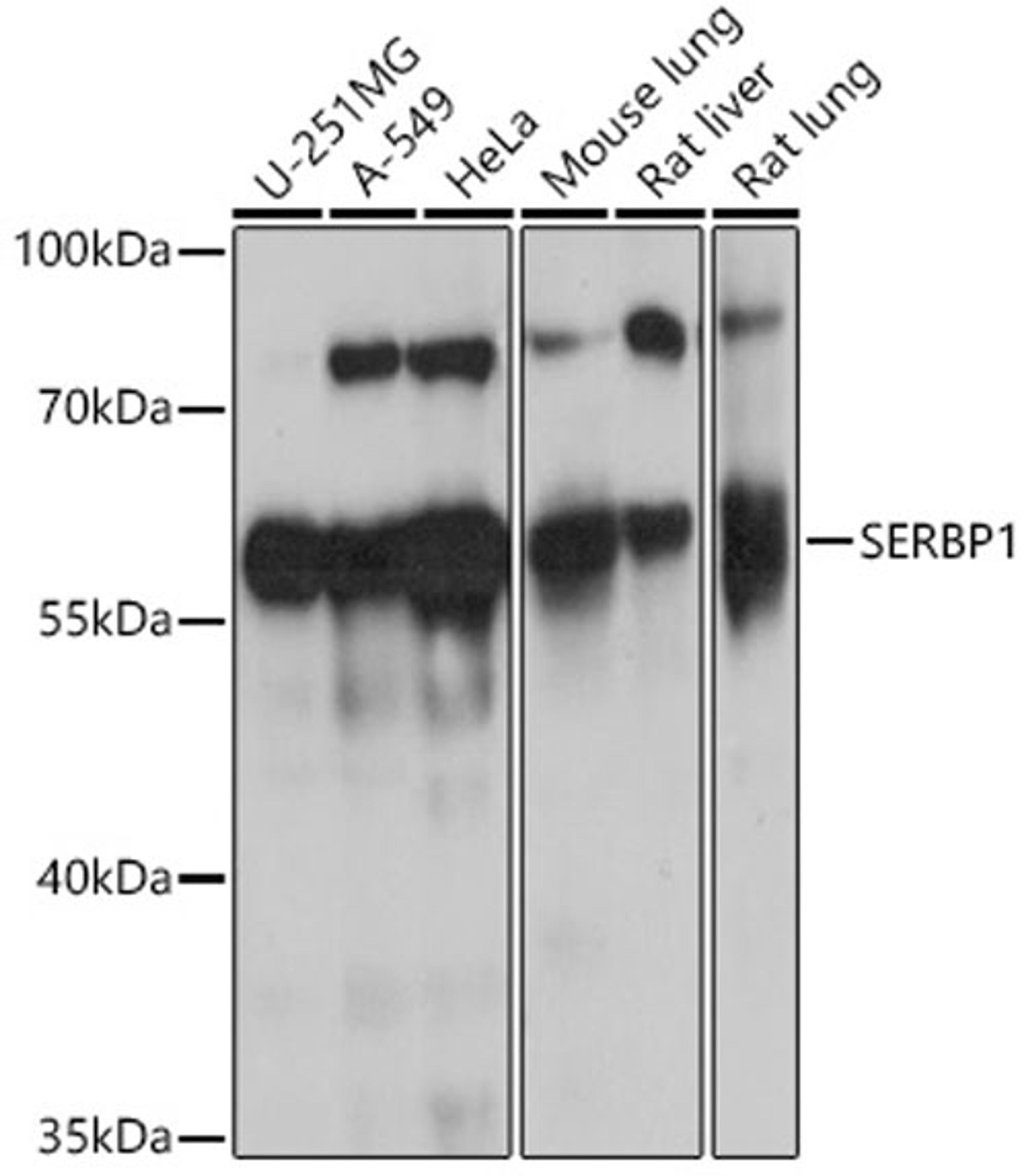 Western blot - SERBP1 antibody (A14870)